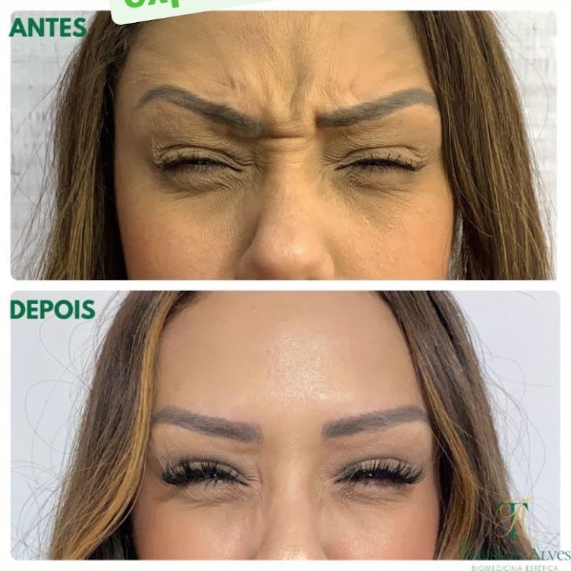 Clínica Estética Avançada Ekos - Clínica de Estética em Centro, Guarulhos/SP - Foto 5