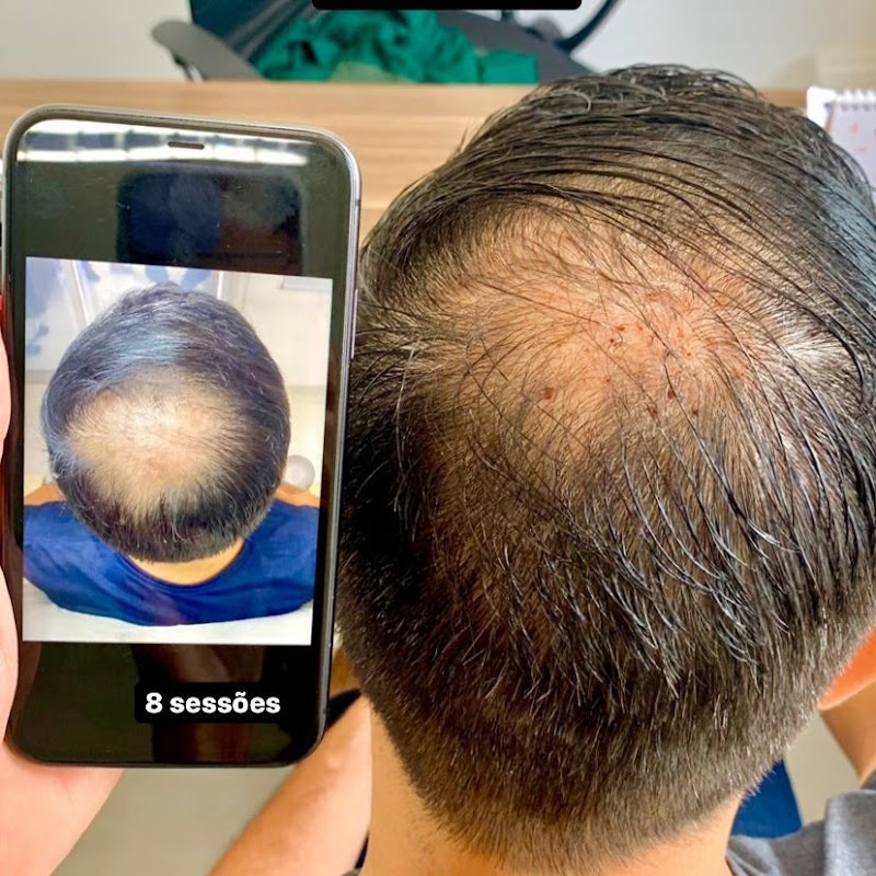 Foto 6 de Clínica Estética Avançada Ekos