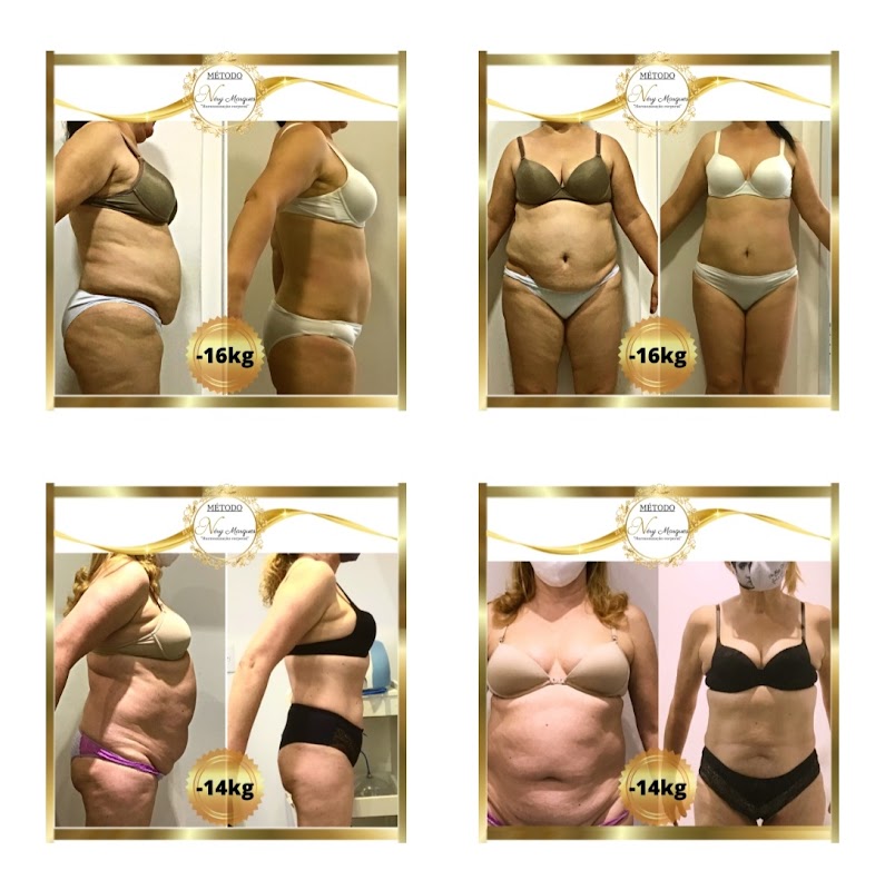 Clínica Néry Marques - Emagrecimento & Harmonização Corporal #MétodoNéryMarques - Clínica de Estética em Centro, Guarulhos/SP - Foto 4