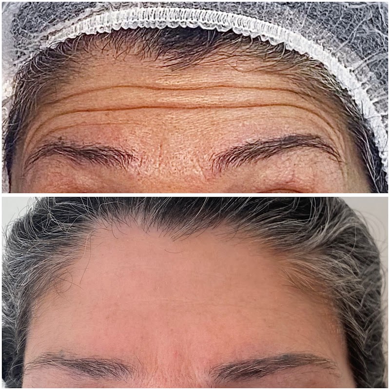 Foto 6 de Dra Beatriz Masano | Rejuvenescimento facial