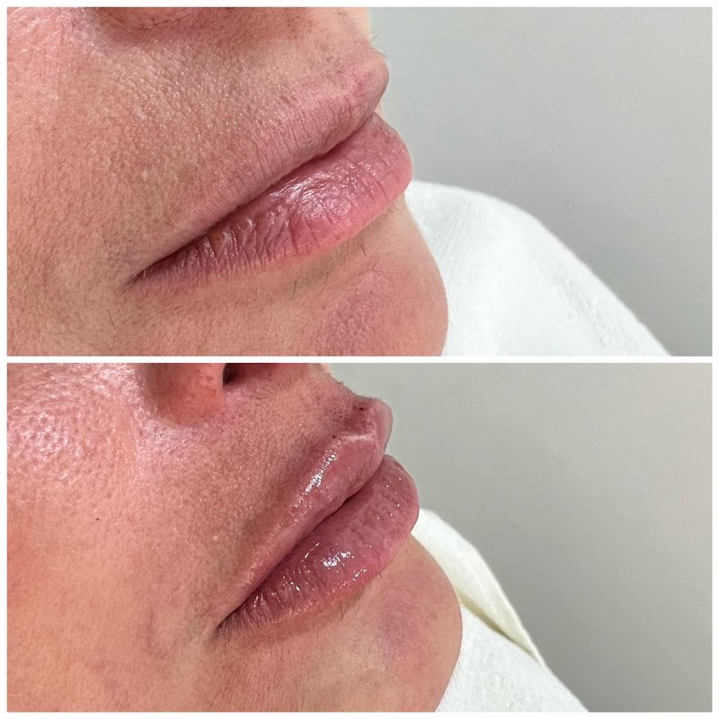 Vittória Estética - Clínica de Estética em Centro, Guarulhos/SP - Foto 5