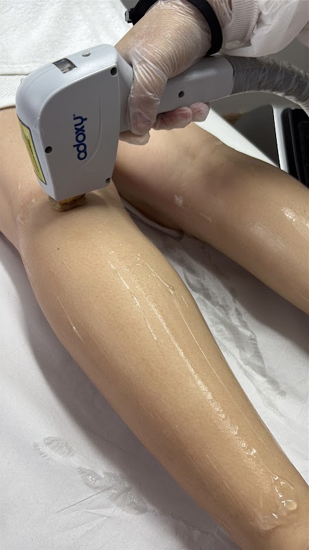 Cuide-se Depilação Laser e Cera - Depilação em Centro, Guarulhos/SP - Foto 5